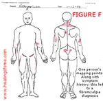 Fibromyalgia test. Blood testing available with some USA medical insurance companies. Mapping is an affordable private compromise if you are asking Why do I have chronic pain through my body? 